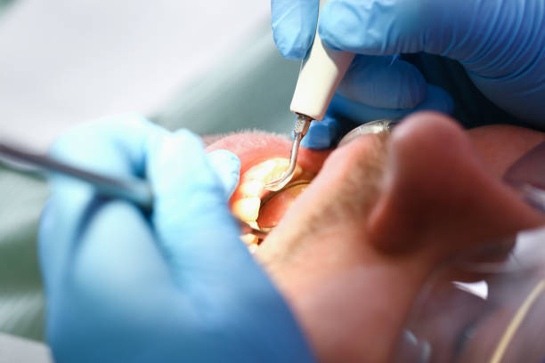 Best Weekend Emergency Dentist in Clinton, TN